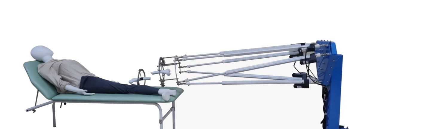 Femur fracture reduction robotics